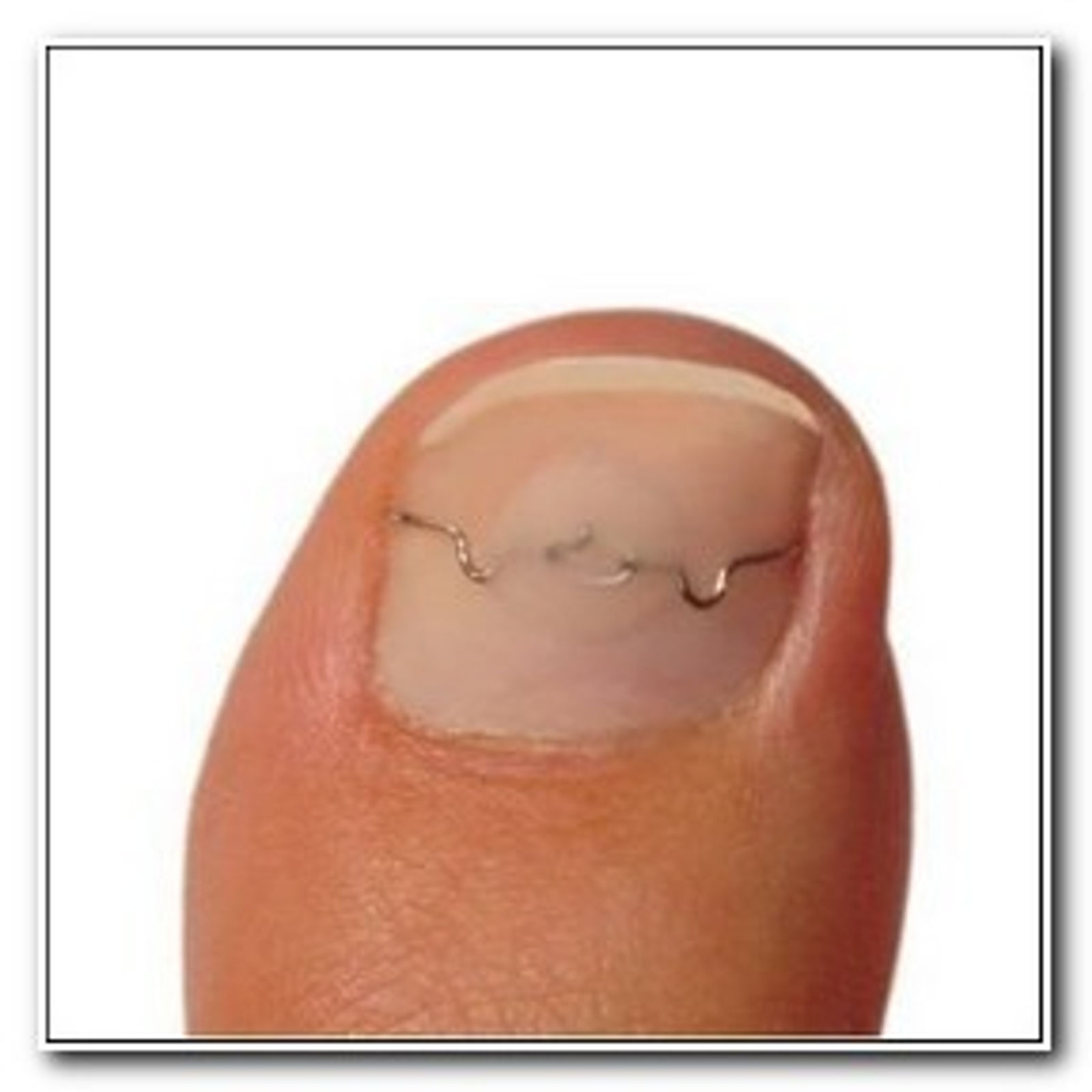 nagelspange-wien.jpg